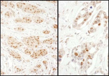 Rabbit anti-Exportin-5 Antibody