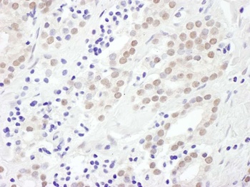Rabbit anti-EXOSC10 Antibody