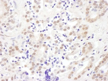 Rabbit anti-EXOSC10 Antibody