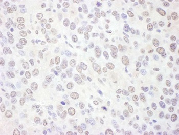 Rabbit anti-EXOSC10 Antibody