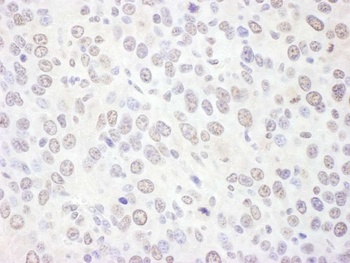 EXOSC10 Antibody