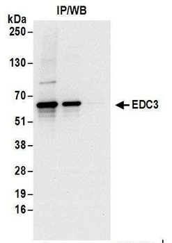 EDC3 Antibody