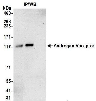 Rabbit Androgen Receptor Antibody