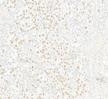 Rabbit Androgen Receptor Antibody