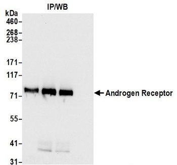 Rabbit Androgen Receptor Antibody