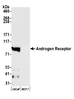 Rabbit Androgen Receptor Antibody