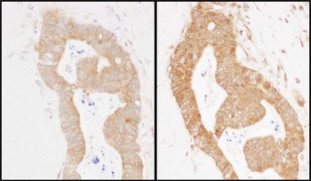 Rabbit anti-MARS Antibody