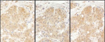 Rabbit anti-EPRS Antibody