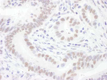Rabbit Sm-D3 Antibody