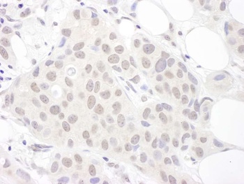 Rabbit Sm-D3 Antibody
