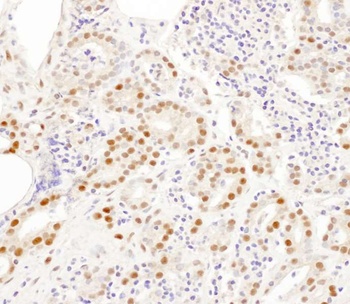 Rabbit anti-SNRPA1 Antibody