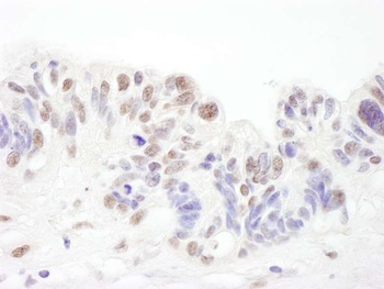 Rabbit anti-SNRPA1 Antibody