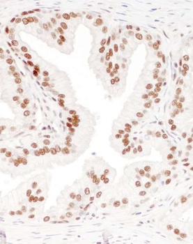 Goat anti-DBC1/p30 DBC Antibody