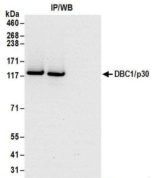 DBC1/p30 DBC Antibody
