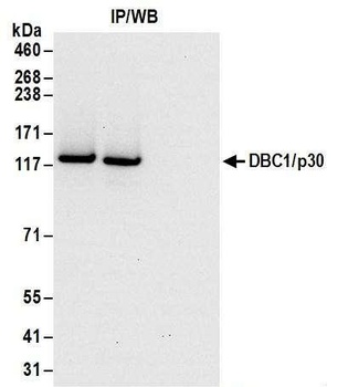 Goat anti-DBC1/p30 DBC Antibody