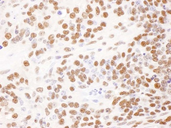 Goat anti-DBC1/p30 DBC Antibody