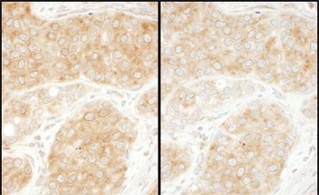 Rabbit anti-RPS11 Antibody