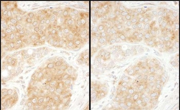 RPS11 Antibody