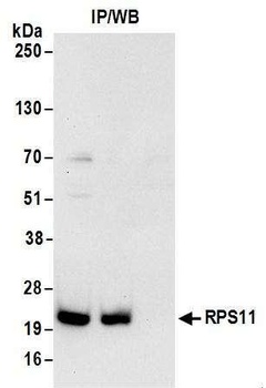 RPS11 Antibody