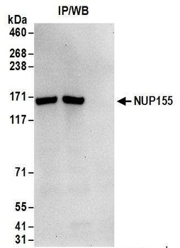 NUP155 Antibody