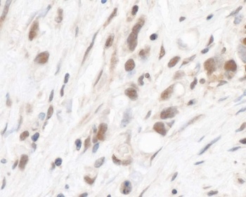Rabbit anti-RPL5 Antibody