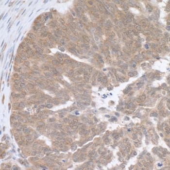 Rabbit anti-RPL5 Antibody