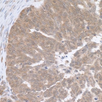 RPL5 Antibody