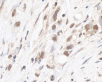 RPL5 Antibody