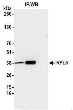 RPL5 Antibody
