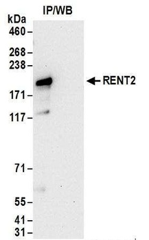 Rabbit anti-RENT2 Antibody