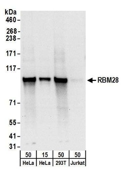 Rabbit anti-RBM28 Antibody