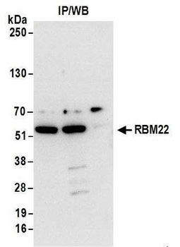 Rabbit anti-RBM22 Antibody