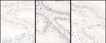 PRPF8 Antibody