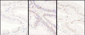 Rabbit anti-PRPF8 Antibody