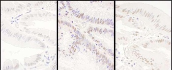 Rabbit anti-PRPF8 Antibody