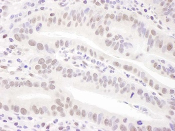 Rabbit anti-PRPF31 Antibody