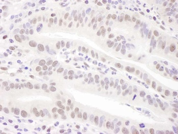 PRPF31 Antibody