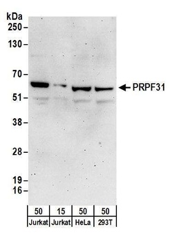 Rabbit anti-PRPF31 Antibody