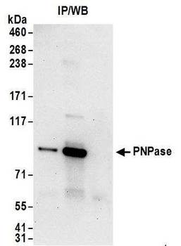 Rabbit PNPase Antibody
