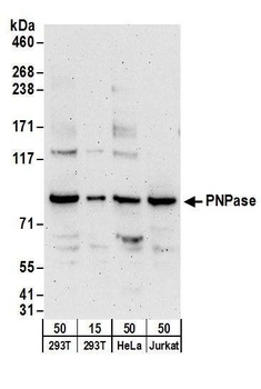 Rabbit PNPase Antibody