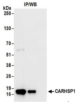 CARHSP1 Antibody