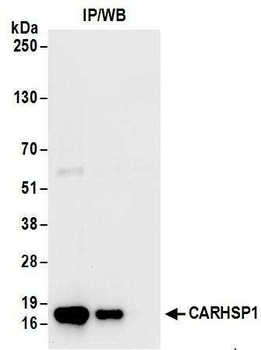 Rabbit anti-CARHSP1 Antibody