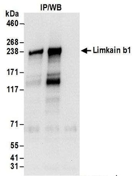 Limkain b1 Antibody
