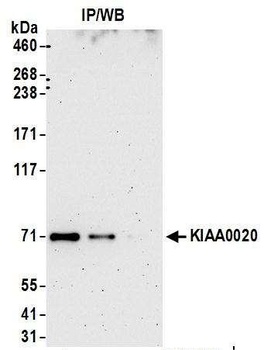 KIAA0020 Antibody