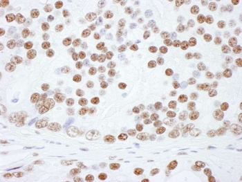 Rabbit anti-hnRNP-L Antibody