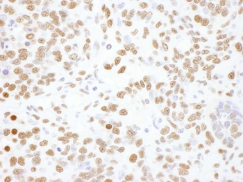 Rabbit anti-hnRNP-L Antibody