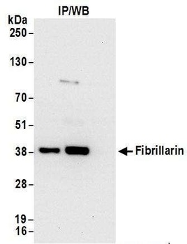 Fibrillarin Antibody