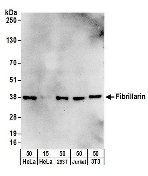 Rabbit Fibrillarin Antibody