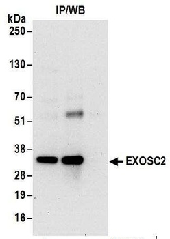 EXOSC2 Antibody