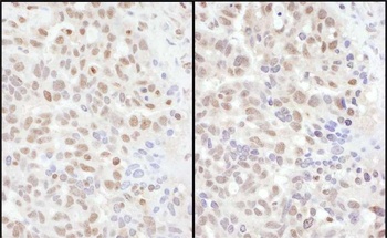Rabbit anti-ADAR1 Antibody